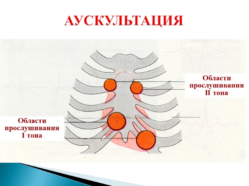 АУСКУЛЬТАЦИЯ Области прослушивания II тона Области прослушивания I тона